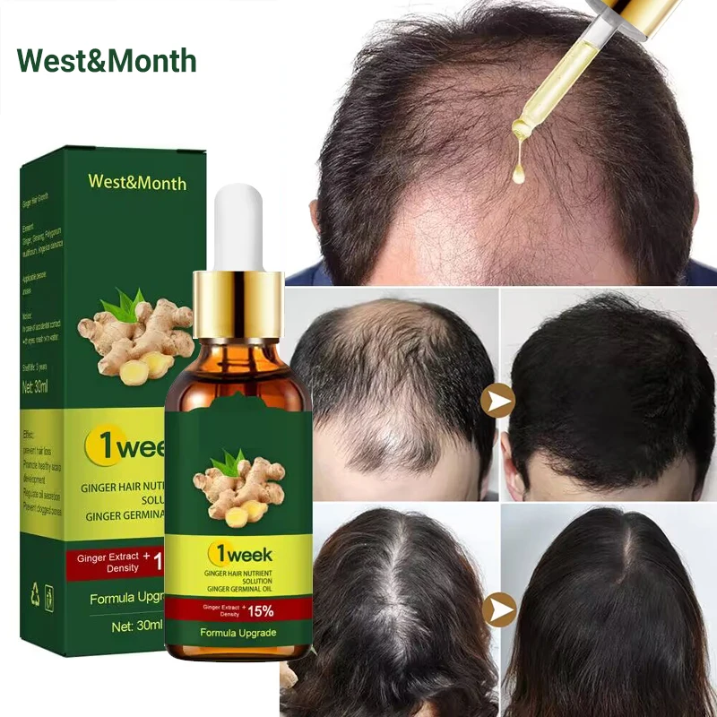 7 Dagen Gember Haargroeiproduc - Licorice Root Sticks recensie en prijs